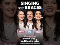 Singing with Braces: Comparing BEFORE, DAY 1 and NOW 😁 Preview! 🎤 #braces