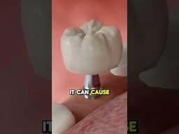 What Happens When You Smoke After Getting Your Teeth Pulled?