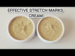 How To Make Effective Stretch Marks Removal Cream at Home