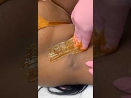 SUGARING | SUGAR WAX #waxing #sugarwaxing #sugaring #hairremoval
