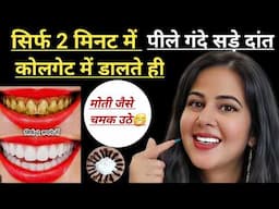 सिर्फ 2 मिनट में पीले गंदे दांतों को मोती की तरह चमका देगा यह घरेलू नुस्खा / Teeth whitening remedy
