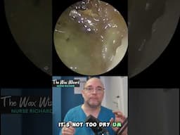 For the full video click on the link attached! #satisfying #earwax  #ear #foryourpage #earwaxremoval