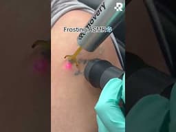 ASMR: Tattoo removal ❄️ #removery #asmr