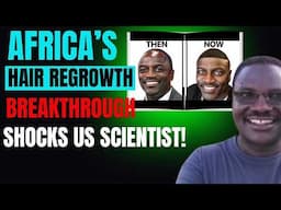 US Scientists Stunned as Africa Unveils Breakthrough in Hair Regrowth  Better Than Hair Transplants!