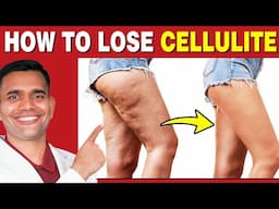 Say Goodbye to Cellulite Naturally | Natural Herbs and Simple Tips