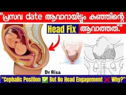 Baby head down position | Cephalic position Malayalam| Reason for Baby Head not Fixed