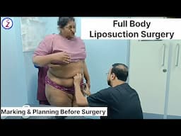Liposuction In Hyderabad | Get READY for a NEW You with Liposuction in Hyderabad!