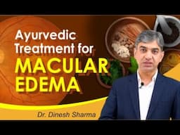 Ayurvedic Treatment for Macular Edema | Safe and Natural Eye Care at Prakash Nethralaya