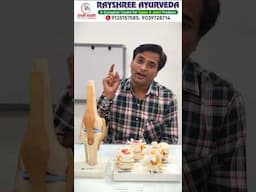 घुटनों के दर्द और गठिया बाय का सफल आयुर्वेदिक इलाज | No Operation | Dr. Manish Yadav | 9125157585