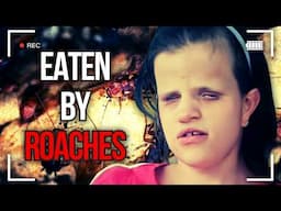 Father Leaves Disabled Daughter To Be Devoured By Roaches In Group Home