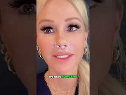 Suture Removal After Lip Lift Surgery