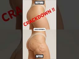 HUGE CRACKDOWN on AESTHETIC PROCEDURES!!!