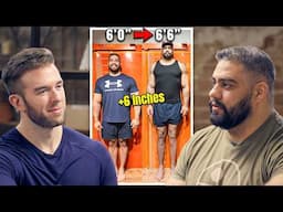 This Should Be IMPOSSIBLE - 365lb Man GREW 6 INCHES!? | Brian Sanchez’s Limb Lengthening Surgeries
