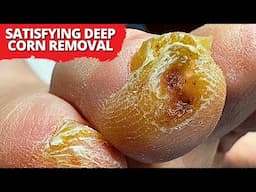 Insane Deep Corn Extraction – Unexpected Discovery Beneath! 😱