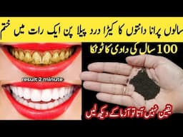 Best Teeth cleaning remedy,how to clean ur yellow teeth,smartly save your money 🤑 & time with 1thing