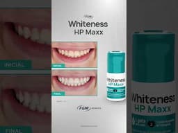A Linha Whiteness oferece uma gama de clareadores que atende cada especificidade do seu paciente ✨