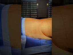 Live from the Operating Room: extended tummy tuck and waist liposuction