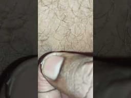 1 Minute Of Top ASMR Pimple Popping Video №101