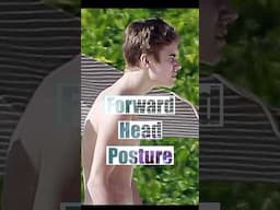 🚨 Fix Your Forward Head Posture – Before It Gets Worse