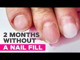 Nail Fill or Fresh Extensions For Two Month Old Nails? | Pink Foil Nail Design
