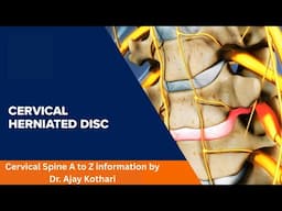 Cervical Spine A to Z information by Dr. Ajay Kothari | Causes, Treatment & Prevention" #pune#doctor