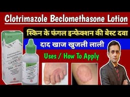 Clotrimazole and beclomethasone lotion /Candid B lotion