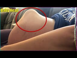 Baby Standing Up In Belly | 15 Videos Humans Were Never Meant To See 😵‍💫