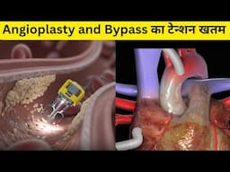 Heart blockage का टेन्शन खतम