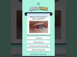 Do you know the answer? 👁️