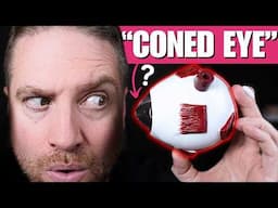 What Is Keratoconus? Is Your Blurry Vision Actually Keratoconus?