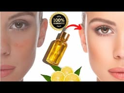 Vitamin C Serum:🌹 vitamin C to remove Dark Spots, Pigmentation, and Sun Tan provides Skin Whitening!