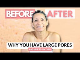 The Truth About Enlarged Pores and How to Fix Them Naturally | Peaches Skin Care