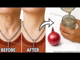 Magic anti-aging cream, 🧅 This cream will remove all the wrinkles on your face, stronger than Botox