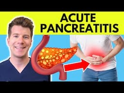 Doctor explains Acute Pancreatitis | Causes, Symptoms, Treatment
