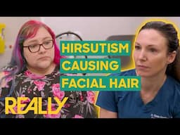 Dr. Emma Helps Woman Suffering From Facial Hair Caused By Hirsutism | The Bad Skin Clinic