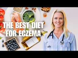 Best Diet for Eczema | The Diet I Eat to Heal Eczema Naturally