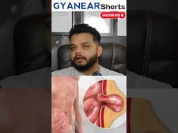 हर्निया क्या है कैसे ठीक करें | Hernia Causes And Treatment #hernia #medical #gyanear