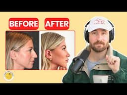 Should you fix your deviated septum? What life is like breathing out of both nostrils!
