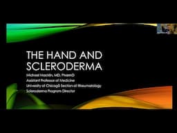 The Hand and Scleroderma, Michael Macklin, MD, PharmD