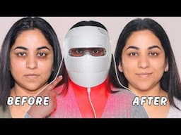 Do LED Masks Really Work? Red Light Therapy at Home (Transformation video)