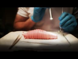 ASMR Mr. Slug Gets a Transplant (Whispered Exam)