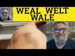 🔵 Weal Meaning - Welt Examples - Wale Defined - Weal Definition - Welt Explained - Define Wale - C2