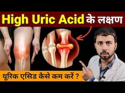 Uric acid home treatment | Uric acid control food | Uric acid foods to avoid | uric acid ka ilaj