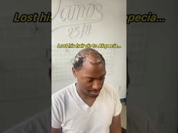 He was SHOCKED by his new hair #Damps #hairunit #hairsystem #hairfibers #montreal #toronto