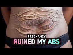 Birth Myths & Facts