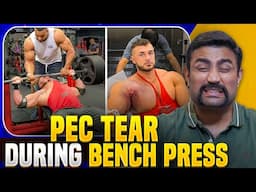 Save Your Chest - How to Prevent Pec Tears !!