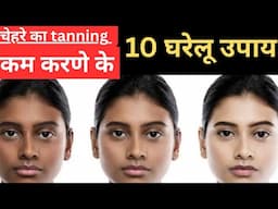 Tanning removals home remedies||tanning kaise hataye||tanning remove from face||tanning remove