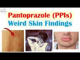 3 Strange Skin Effects of Pantoprazole (PPIs)
