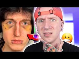 Tongue Piercing ROTTED In Her Mouth | Roly