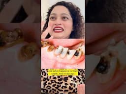 Is YOUR DAUGHTERS TEETH BLACK ? 😭